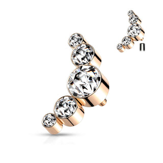Top 5 Zirconia Internally Threaded